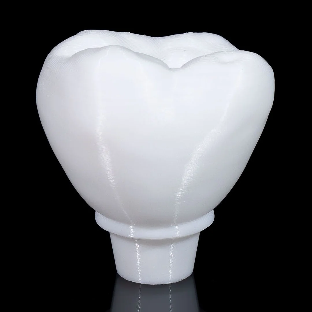 Close view of the removable tooth crown from a dental implant model.