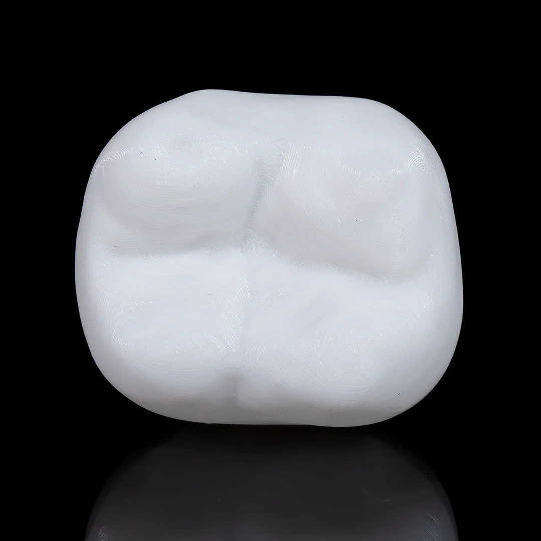 Top view of the tooth crown from a dental implant model.