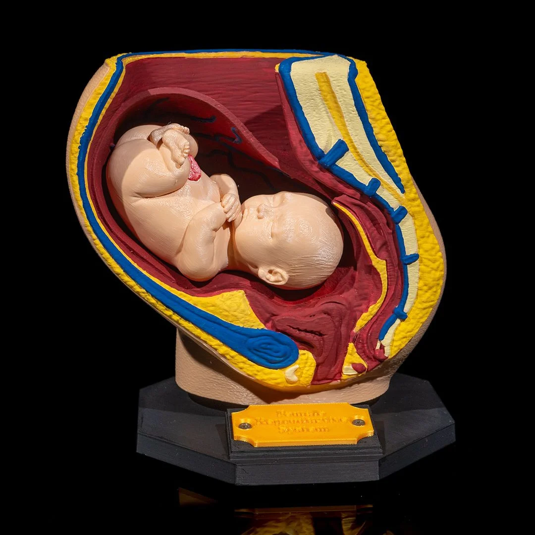Front view of a pregnancy cross-section model showing the fetus and surrounding structures.