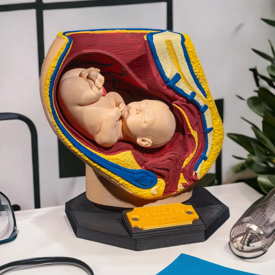 Open cross-section of a pregnancy teaching model with the fetus visible.