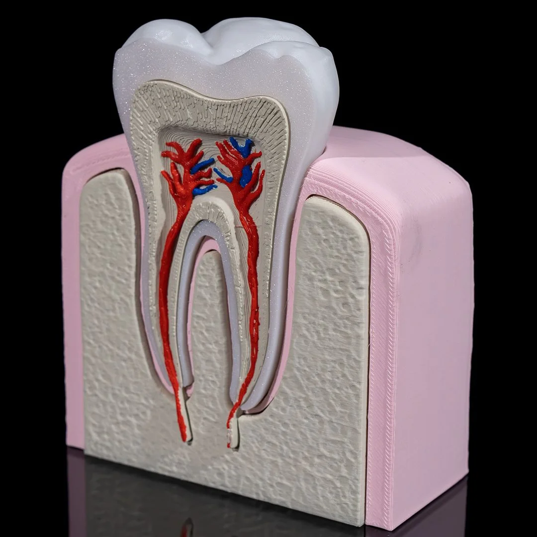 Angled view of a tooth anatomy model within a gum and jaw section.