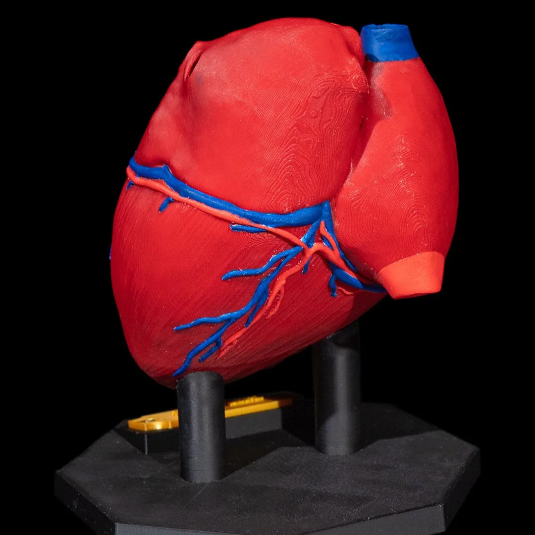 Rear angle of a heart model showing surface vessels.