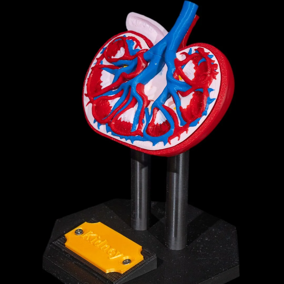 Angled view of a kidney cross-section showing internal structures.