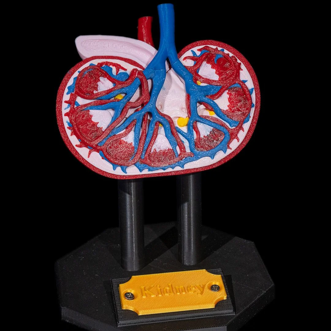 Close front view of a kidney model with internal vessels visible.