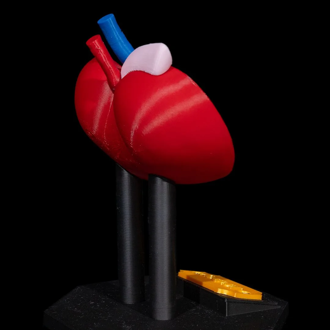 Opposite rear angle of a kidney anatomy model.