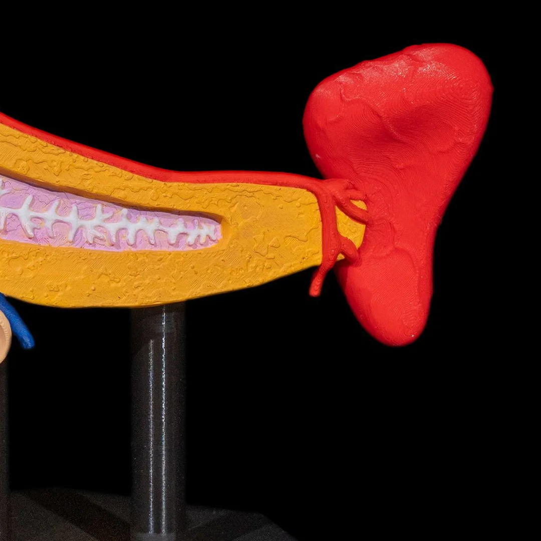 Close view of the pancreas model and adjoining spleen.
