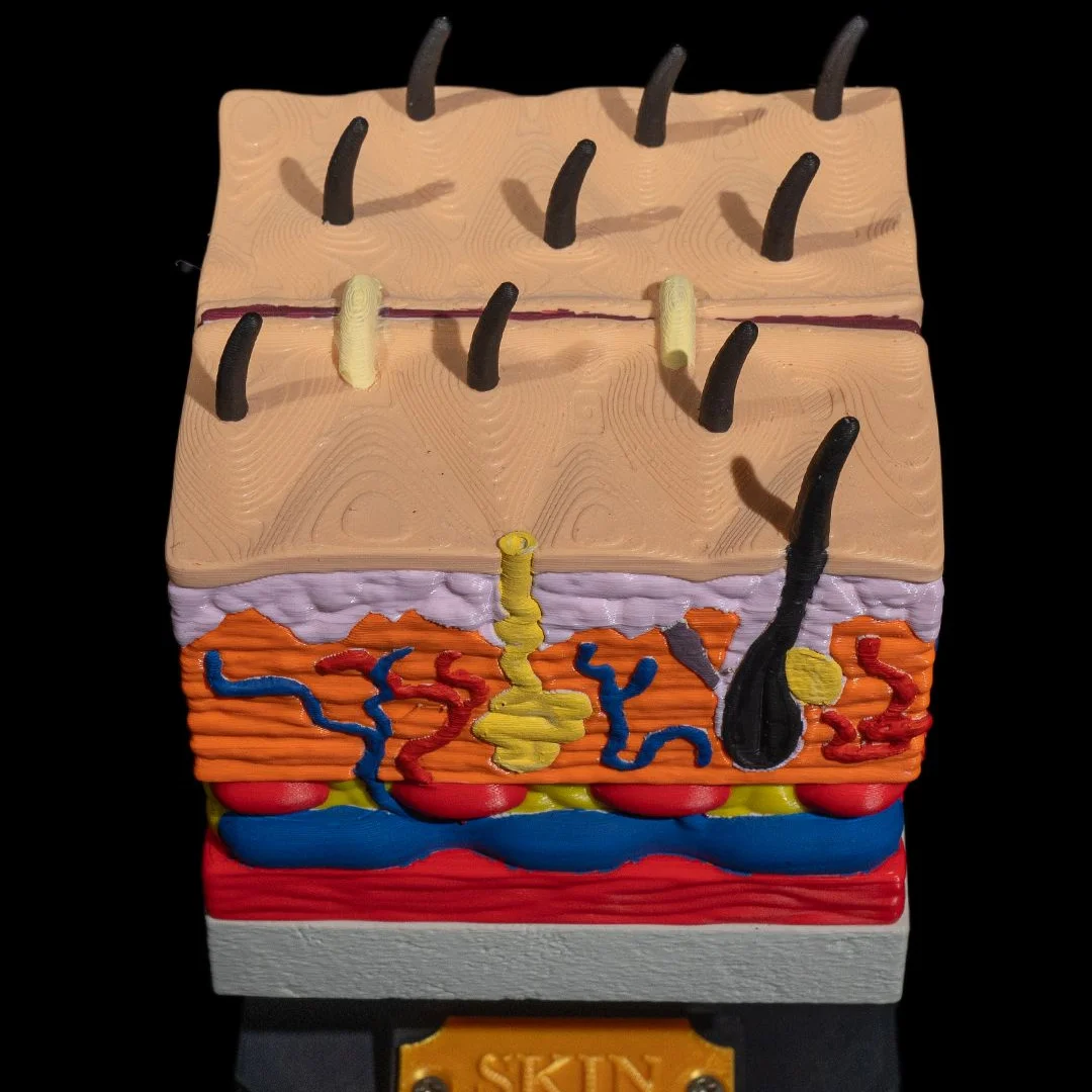 Top angle of a skin cross-section with a removable surface section.