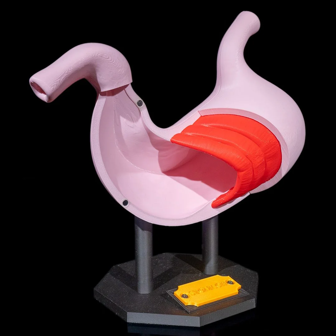 Opened stomach model showing internal layers on a display stand.